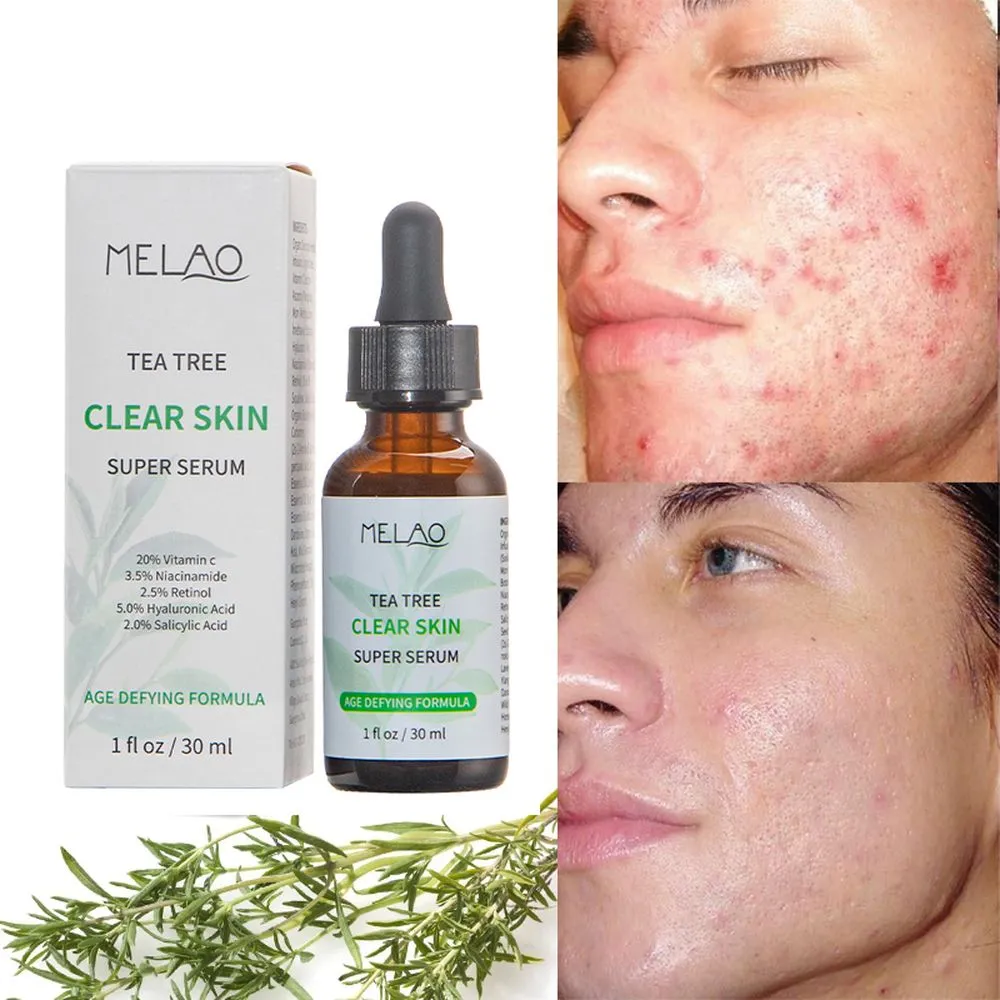Melao Tea Tree Clear Skin Super Serum 30Ml