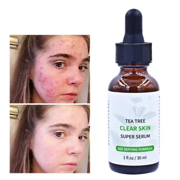 Melao Tea Tree Clear Skin Super Serum 30Ml
