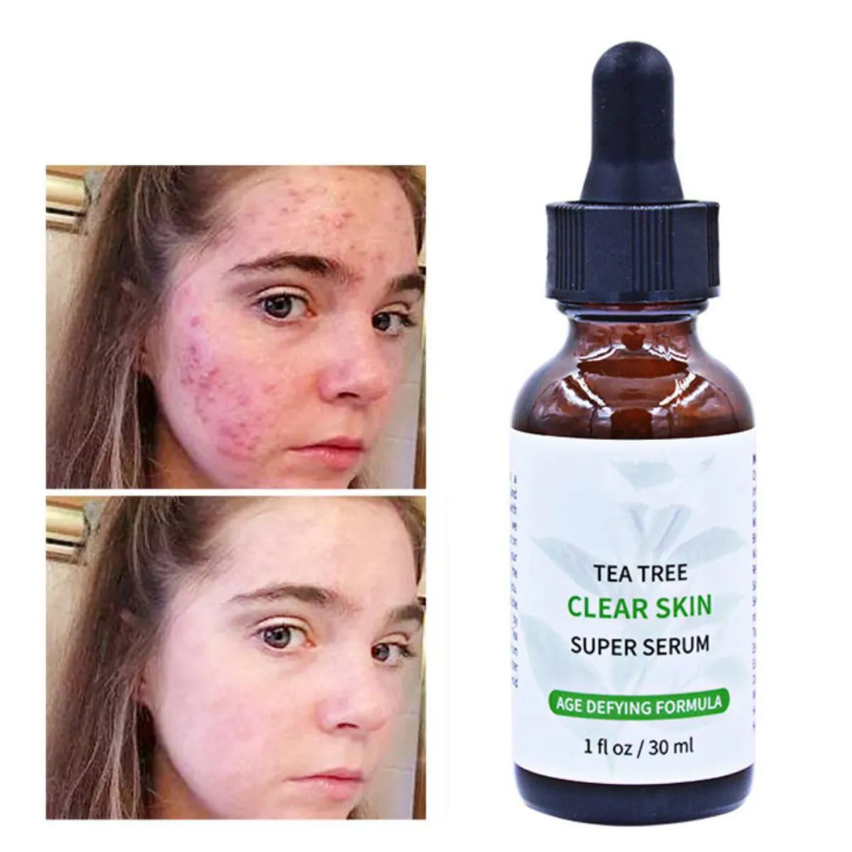 Melao Tea Tree Clear Skin Super Serum 30Ml