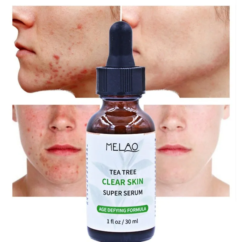 Melao Tea Tree Clear Skin Super Serum 30Ml