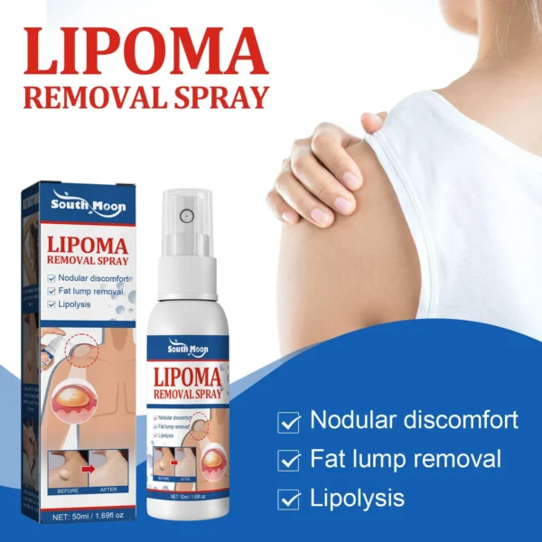 Lipomas Removal Spray Relief Pain Treat Skin Swelling 50ml Nodule Lipolysis Cellulite Removal Ointment Spray Lump Fat V5P6