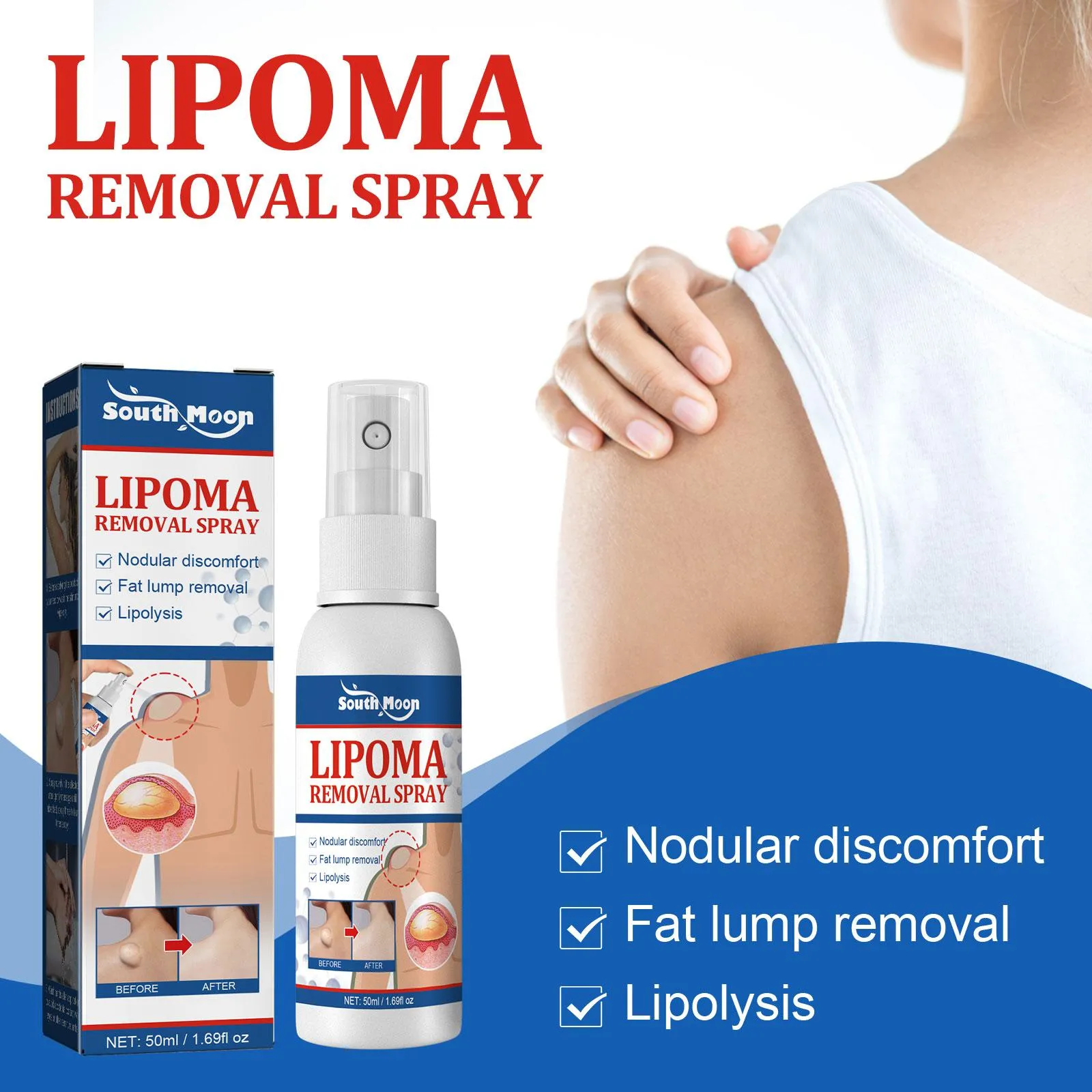 Lipomas Removal Spray Relief Pain Treat Skin Swelling 50ml Nodule Lipolysis Cellulite Removal Ointment Spray Lump Fat V5P6