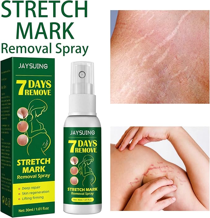 Jaysuing Pregnancy Repair Spray Fade Pregnant Women Pregnancy Fine Lines Postpartum Skin Pregnancy Lines Care Spray