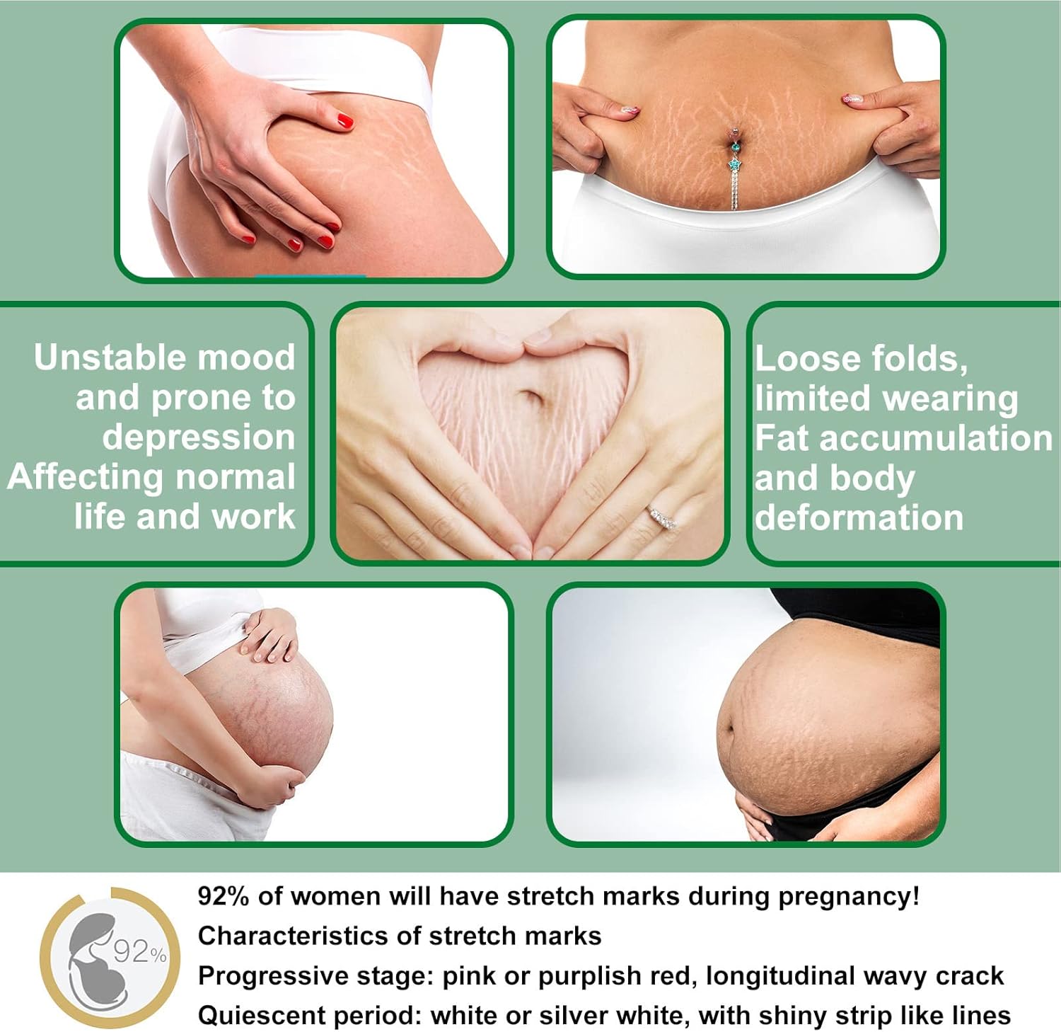 Jaysuing Pregnancy Repair Spray Fade Pregnant Women Pregnancy Fine Lines Postpartum Skin Pregnancy Lines Care Spray