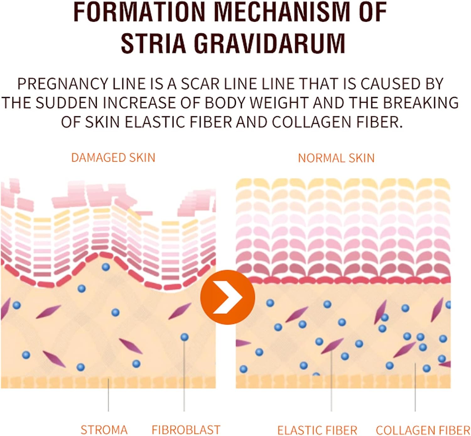 Jaysuing Pregnancy Repair Spray Fade Pregnant Women Pregnancy Fine Lines Postpartum Skin Pregnancy Lines Care Spray