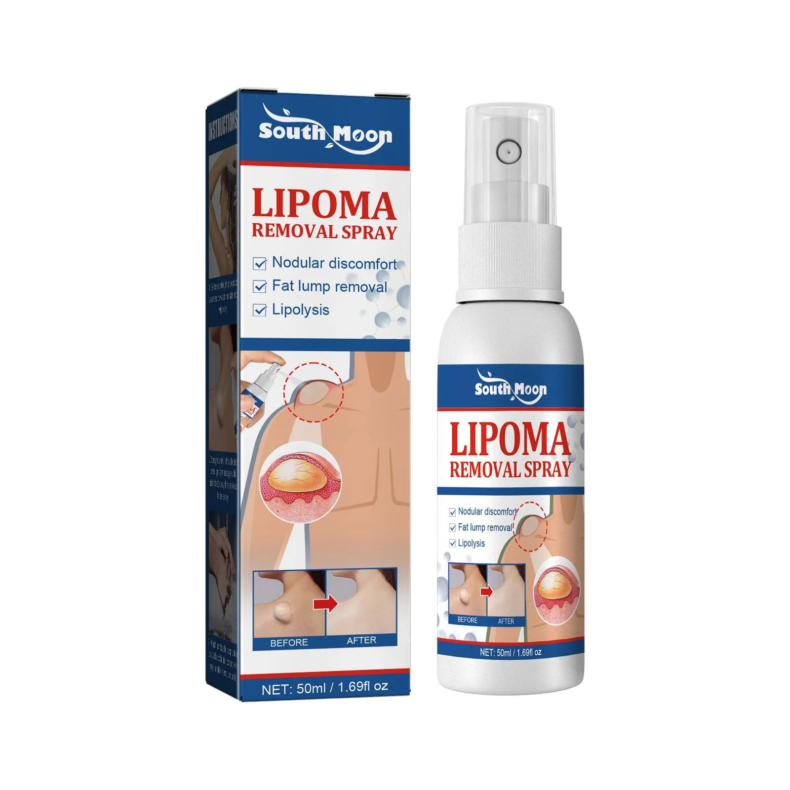 Lipomas Removal Spray Relief Pain Treat Skin Swelling 50ml Nodule Lipolysis Cellulite Removal Ointment Spray Lump Fat V5P6