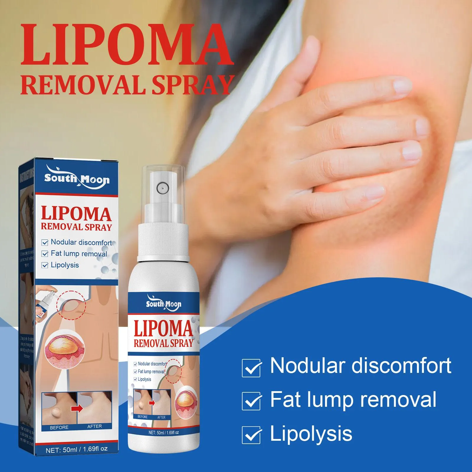 Lipomas Removal Spray Relief Pain Treat Skin Swelling 50ml Nodule Lipolysis Cellulite Removal Ointment Spray Lump Fat V5P6