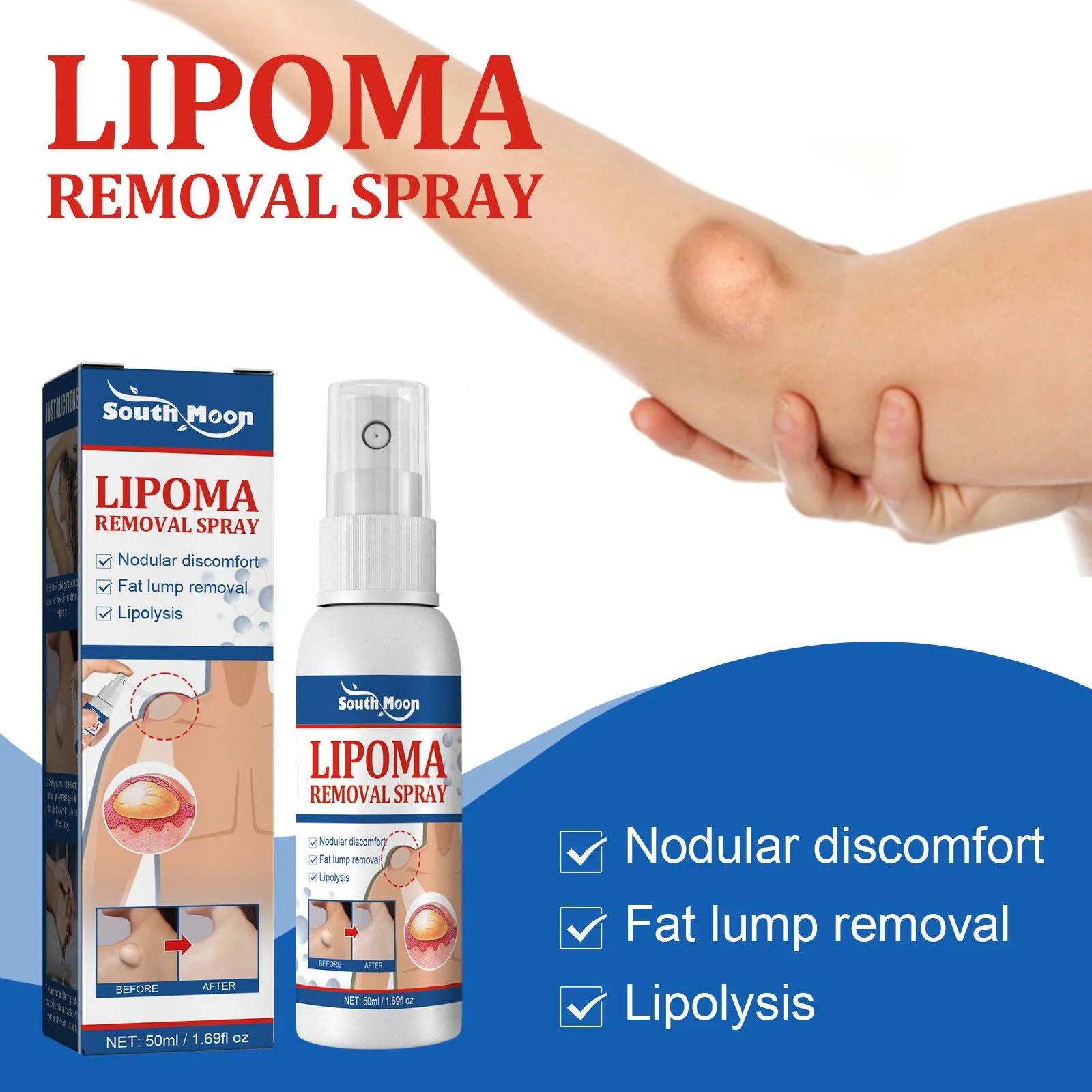 Lipomas Removal Spray Relief Pain Treat Skin Swelling 50ml Nodule Lipolysis Cellulite Removal Ointment Spray Lump Fat V5P6